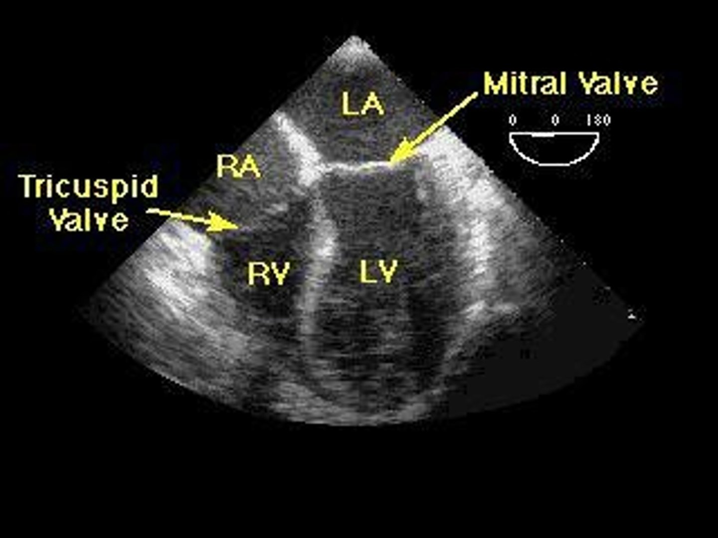 <p>A transthoracic ultrasound of the heart's structure.</p>