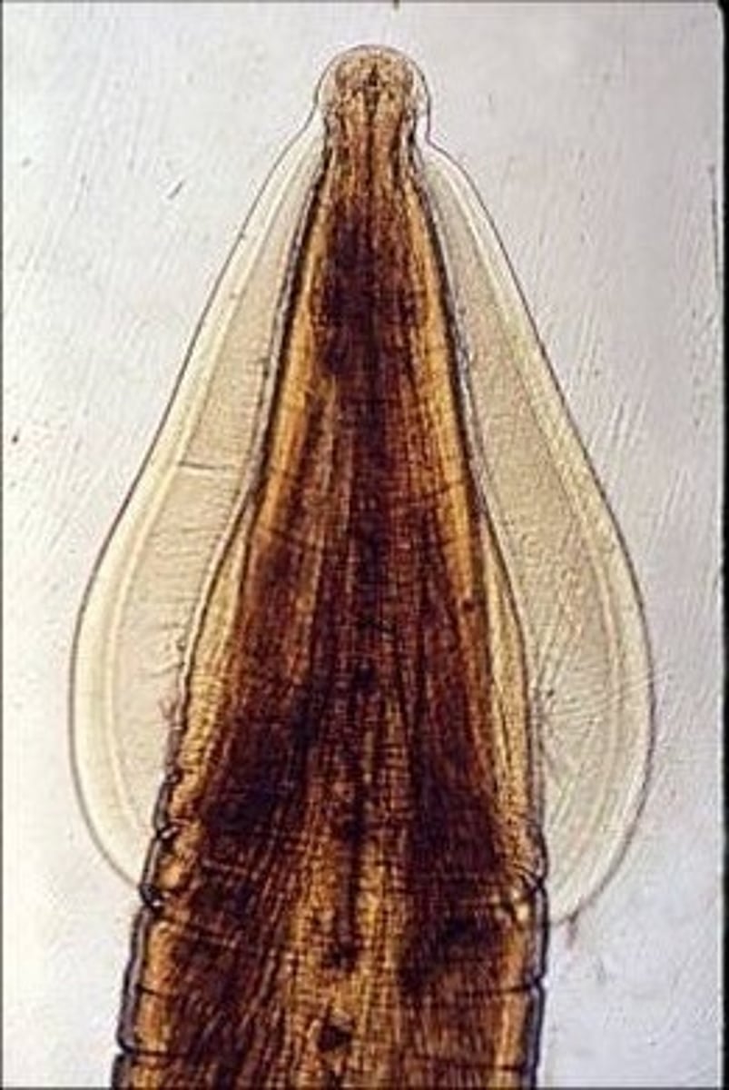 <p>What is this parasite is this if it is from a cat</p>