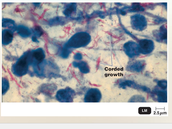 <p>Atypical Cell Walls </p>