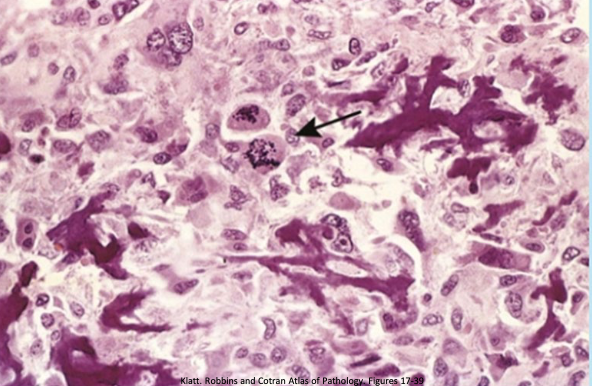 term image