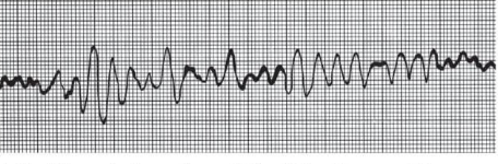 <p>What kind of rhythm is this? </p>