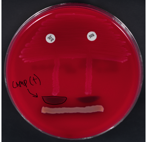<ul><li><p>beta-hemolysis (yellow)</p></li><li><p>group B strep</p></li><li><p>CAMP positive</p></li></ul><p></p>