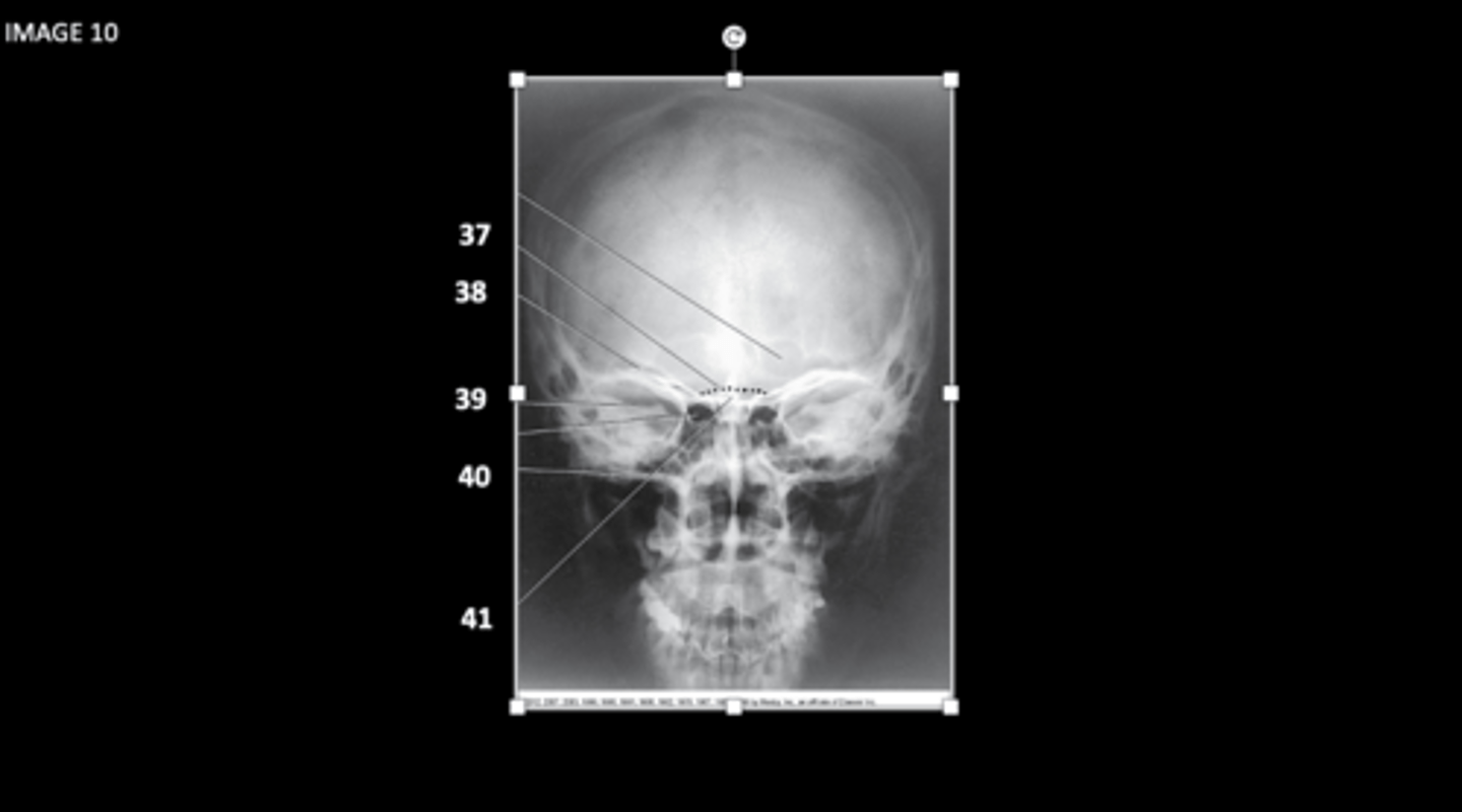 <p>What is 39?</p>