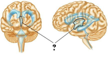 <p><span><span>Identify the indicated space.</span></span></p>