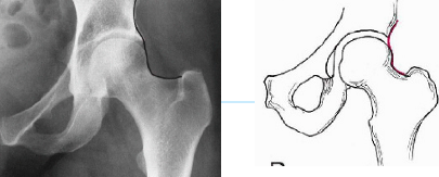 <p>Q what is the name of this measurement? and what is the average + range?</p>