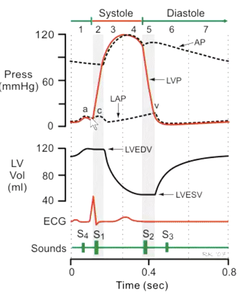 <p>what is S3 sounds caused by?</p>