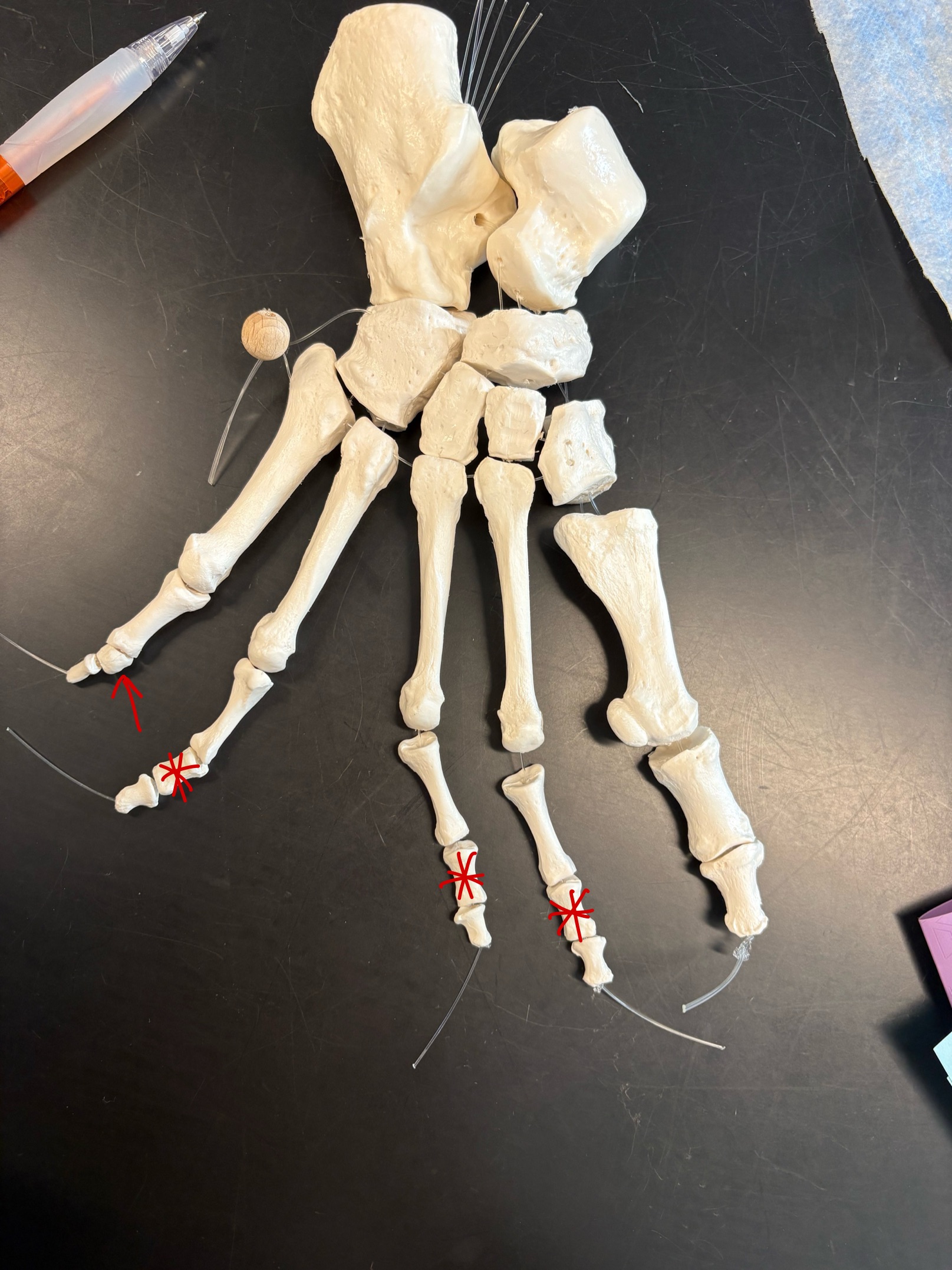 <p>Name these bones</p>