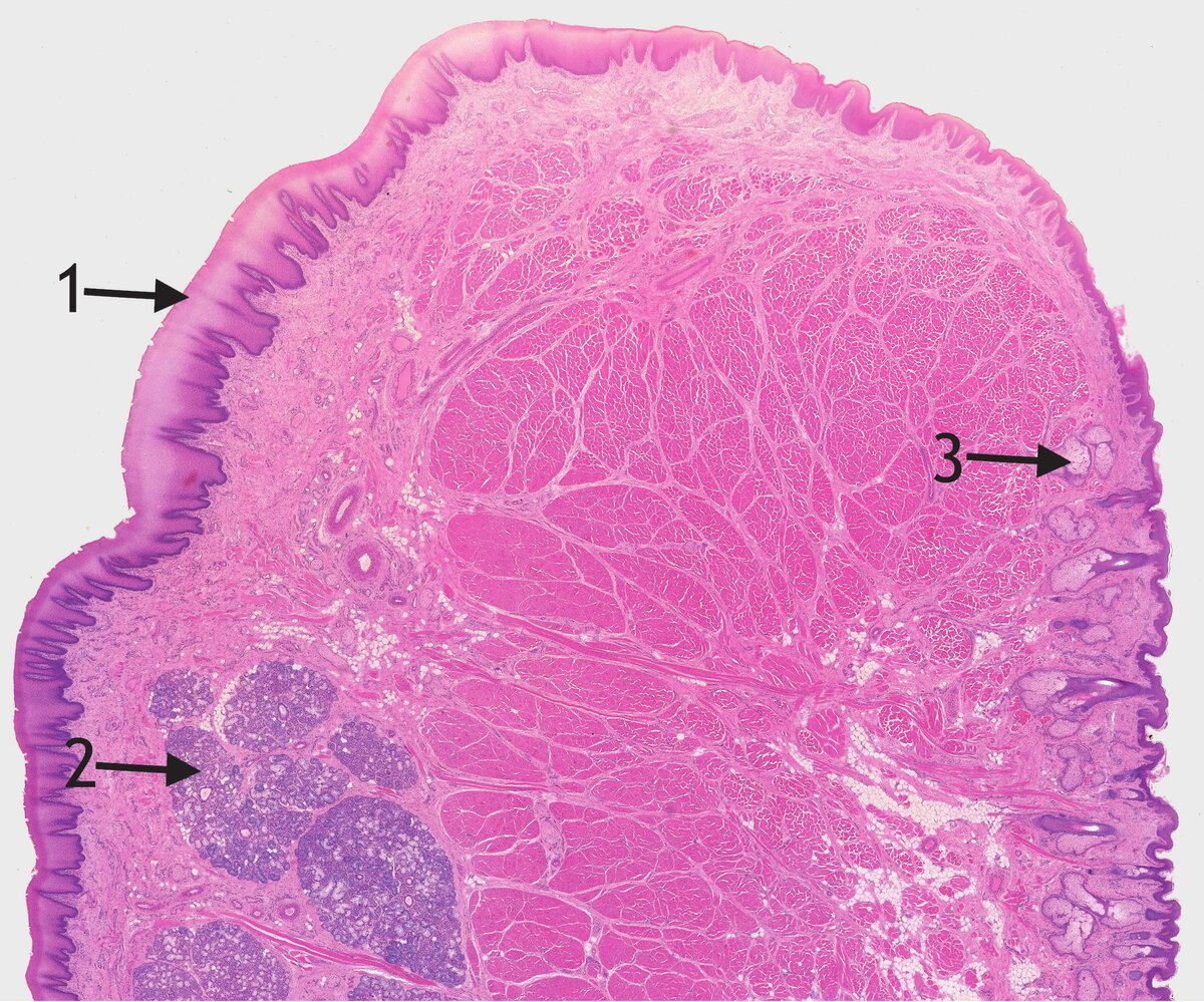 <p>5. Which statement about the histological image is correct?"</p><p>A. The image shows a section through the fingertip.</p><p>B. The image shows a section through the lip.</p><p>C. Arrow 1 points to a transitional epithelium.</p><p>D. Arrow 2 points to lymph follicles.</p><p>E. Arrow 3 points to mucous glands.</p>