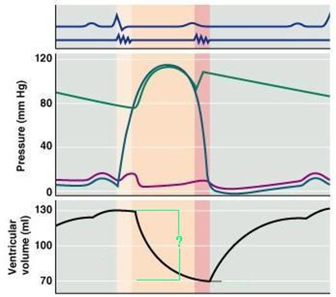 <p>What cardiac cycle volume is indicated on the diagram?</p>