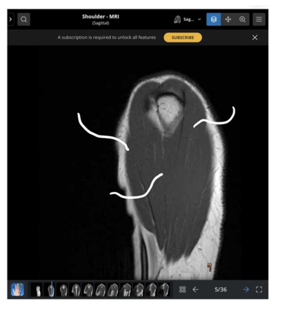 <p>From left to right, which structures are being pointed to?</p>
