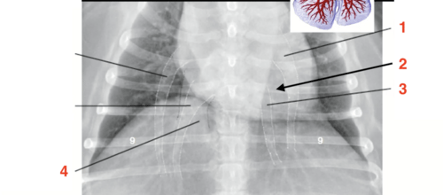 <p>4 (black dots)</p>