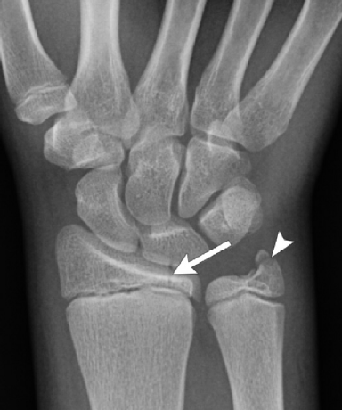 <p>What is wrong with this patient?</p>