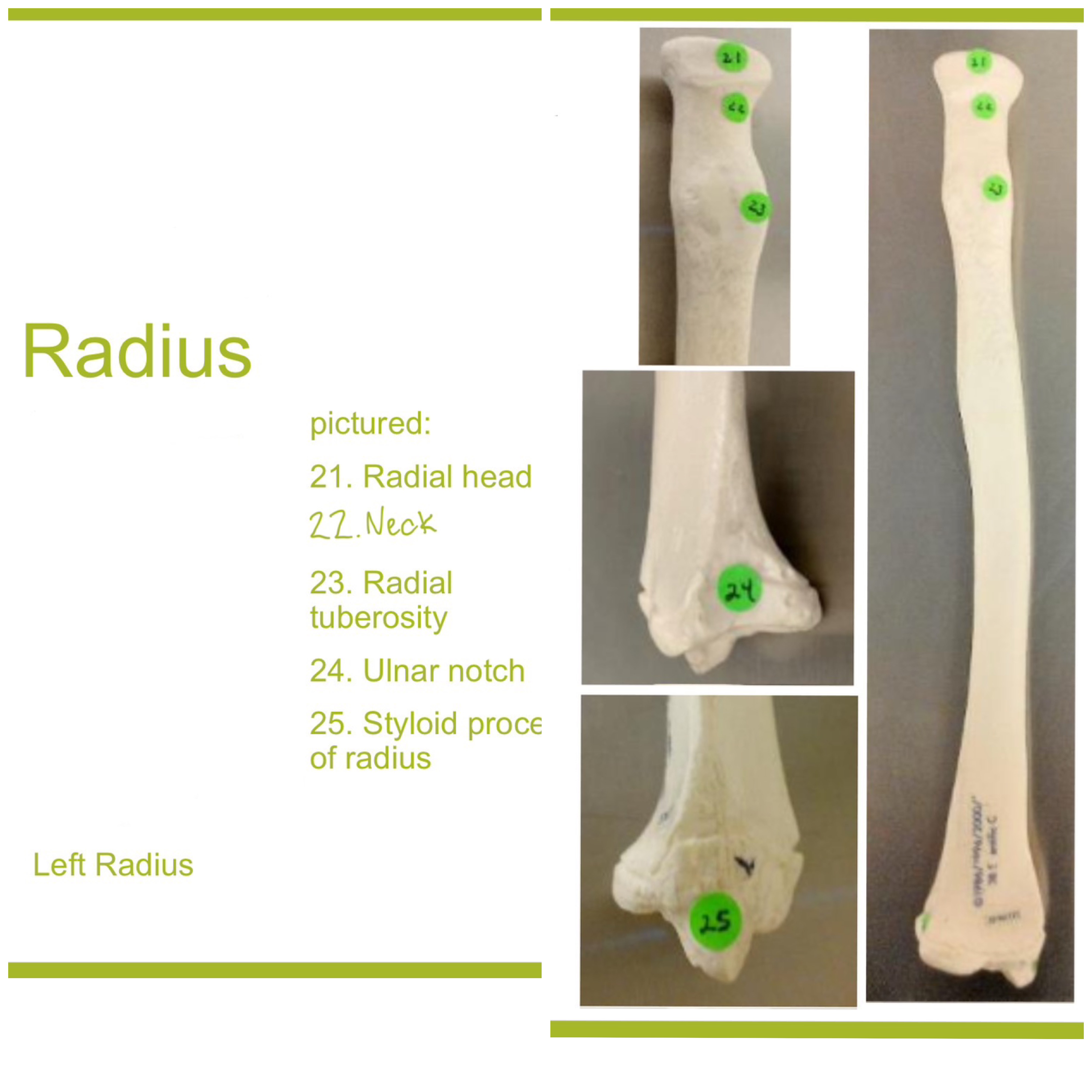 <p>radius</p>