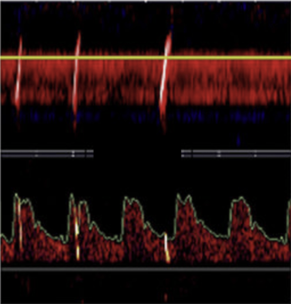 <p>1-10 hits</p>
