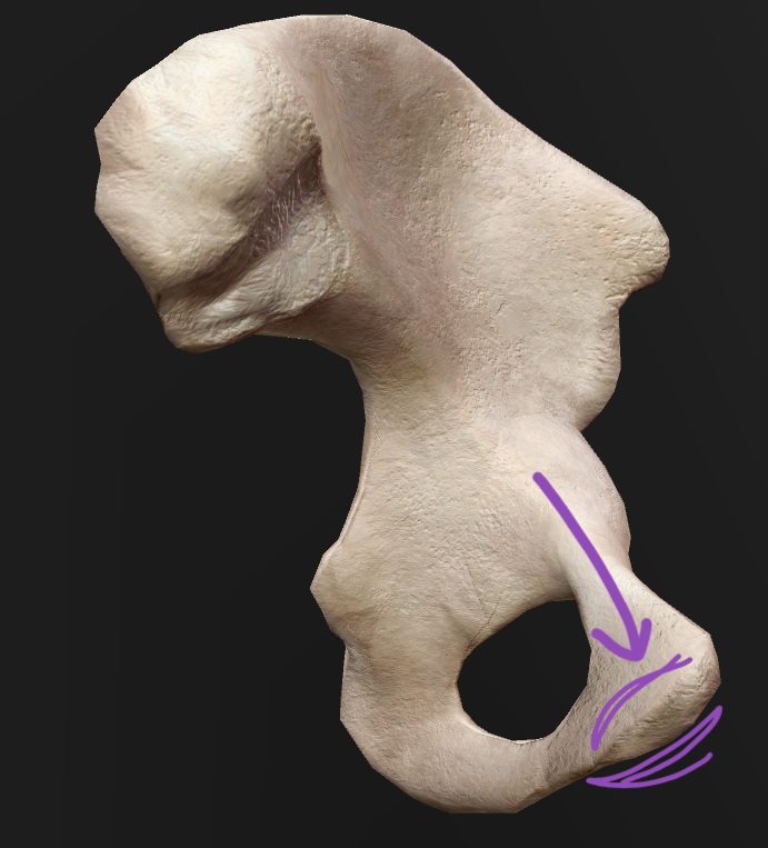 term image