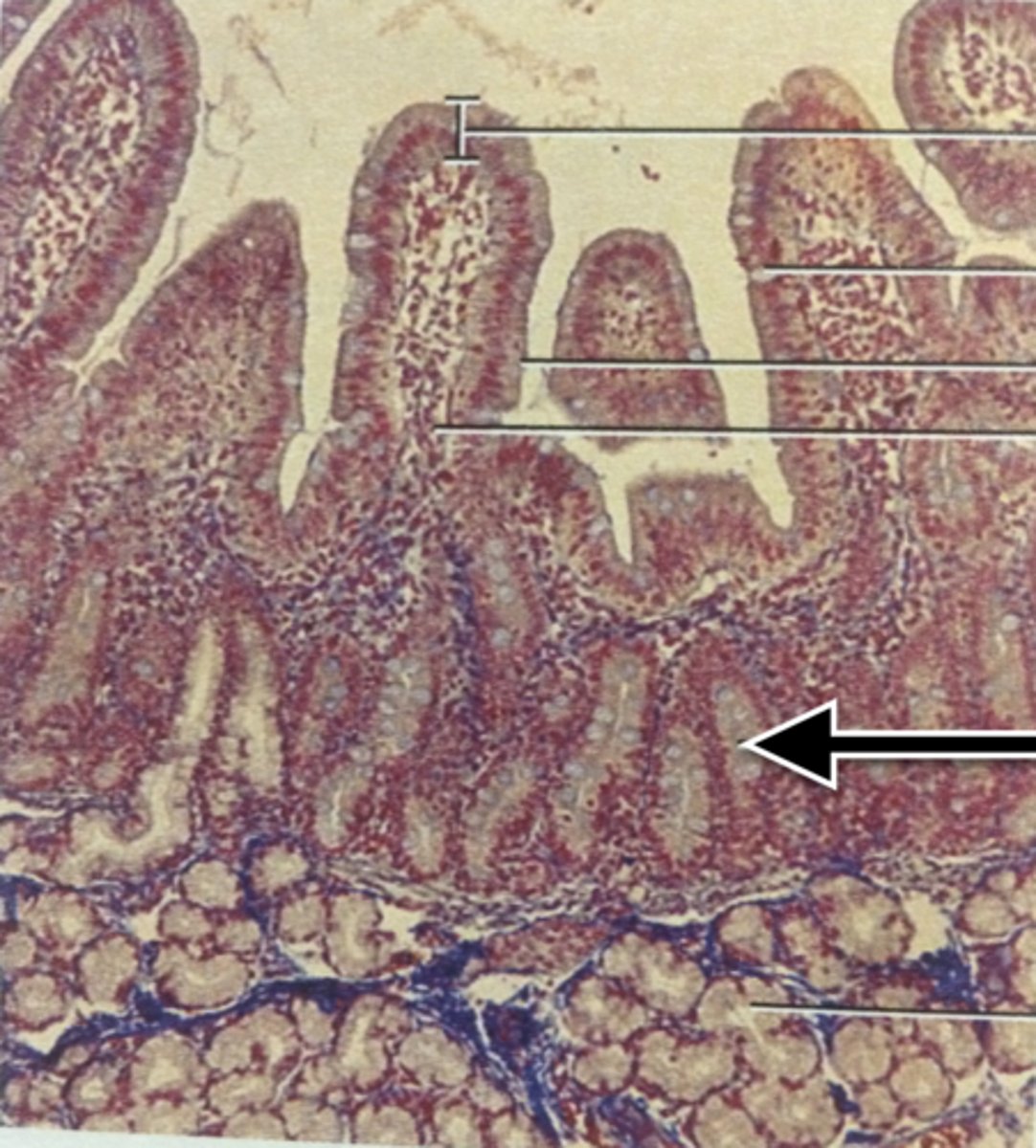 knowt flashcard image