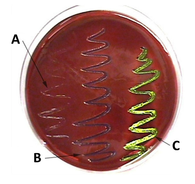 <p>This image shows the results of three different bacterial species grown on MacConkey media. Which bacterial species, if any, are Gram-positive?</p>