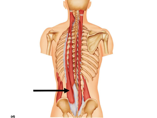 Erector spinae - iliocostalis
Origin:
Insertion:
Action: