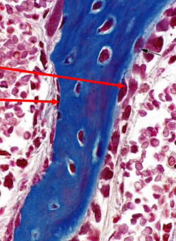 <p>what type of bone cell is this? red arrow</p>