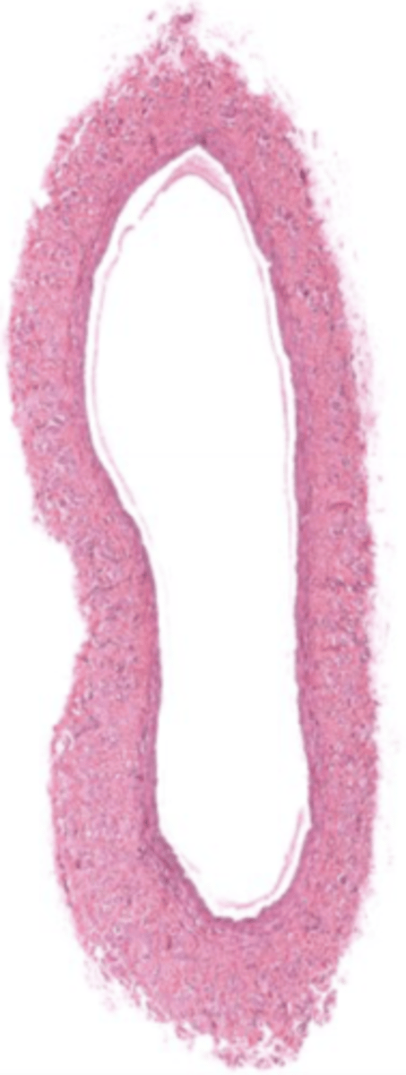 <p>A blood vessel that carries blood back to the heart.</p>
