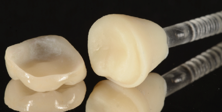 <p>lithium disilicate </p>