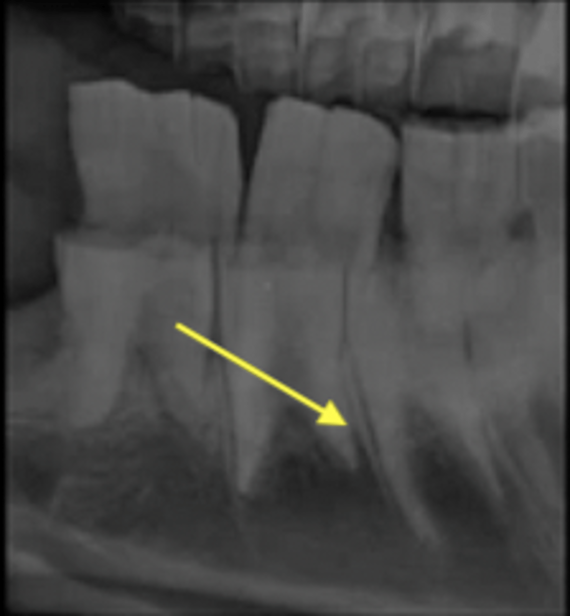<p>What type of joint is pictured?</p>