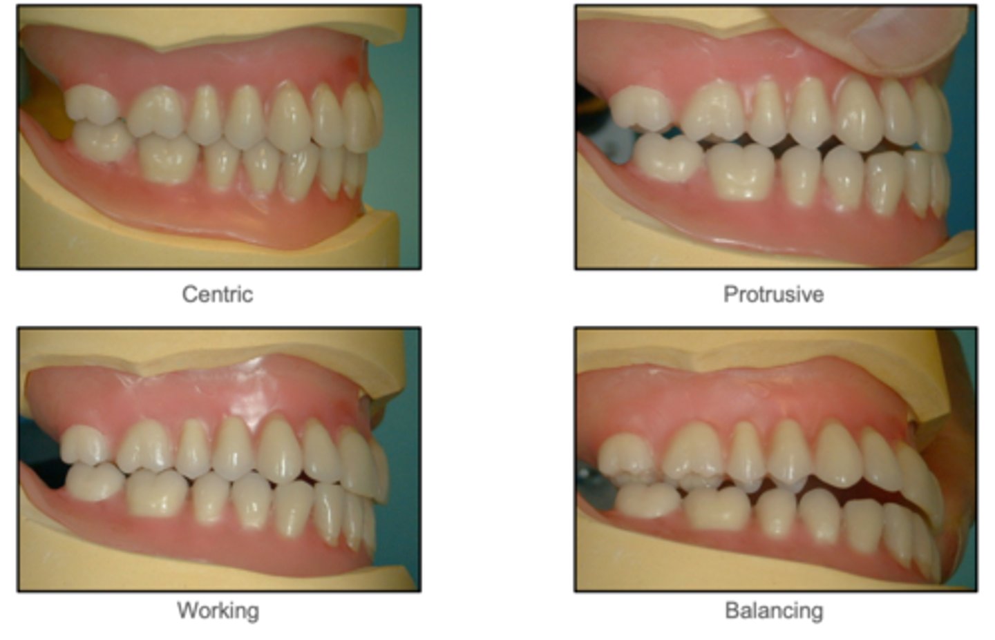 <p>Which occlusal scheme?</p>