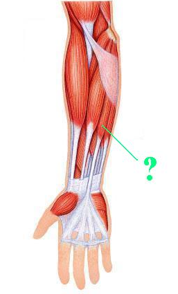 <p><span>Identify the indicated muscle.</span></p>