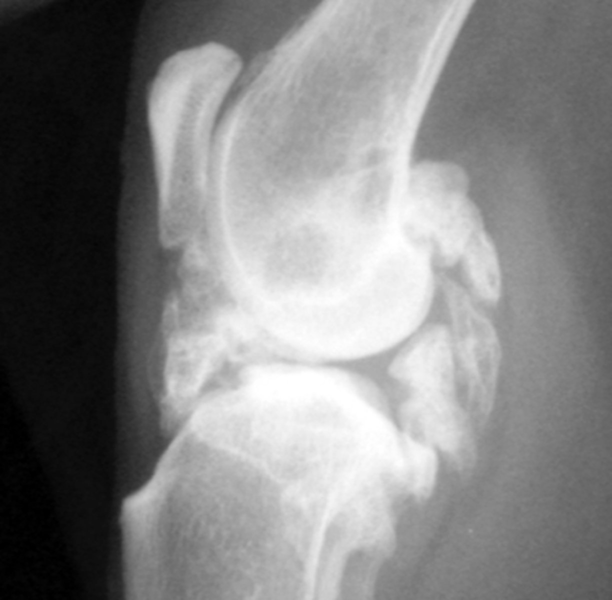 <p>Erosive or non erosive?</p>