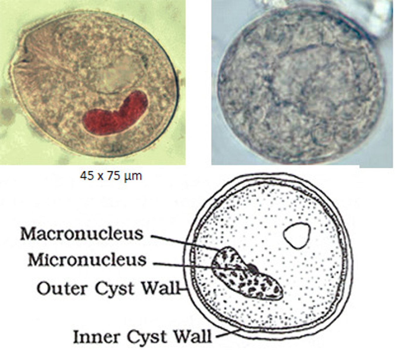 <p>ciliate</p>