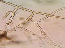 <p><span>Mycelium has septate walls and hyphae connect with 90 degree angles.</span></p>