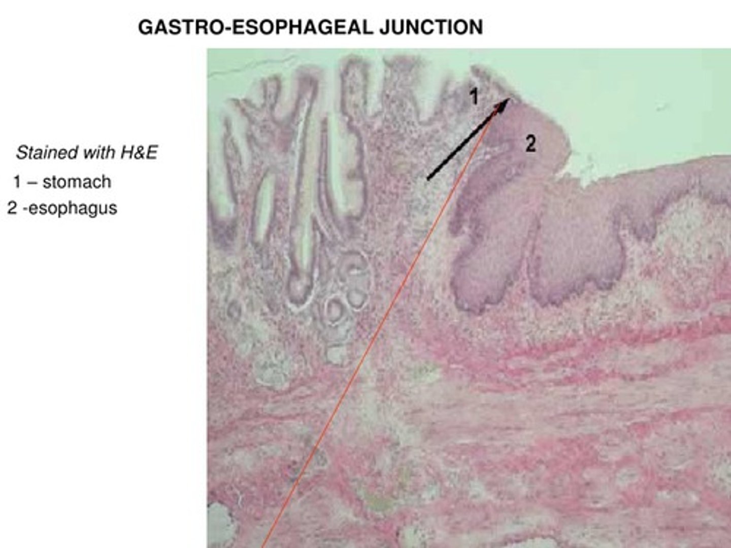 <p>How does the Gastroesophageal Junction appear histologically (between the distal esophagus and the proximal stomach/cardia)?</p>