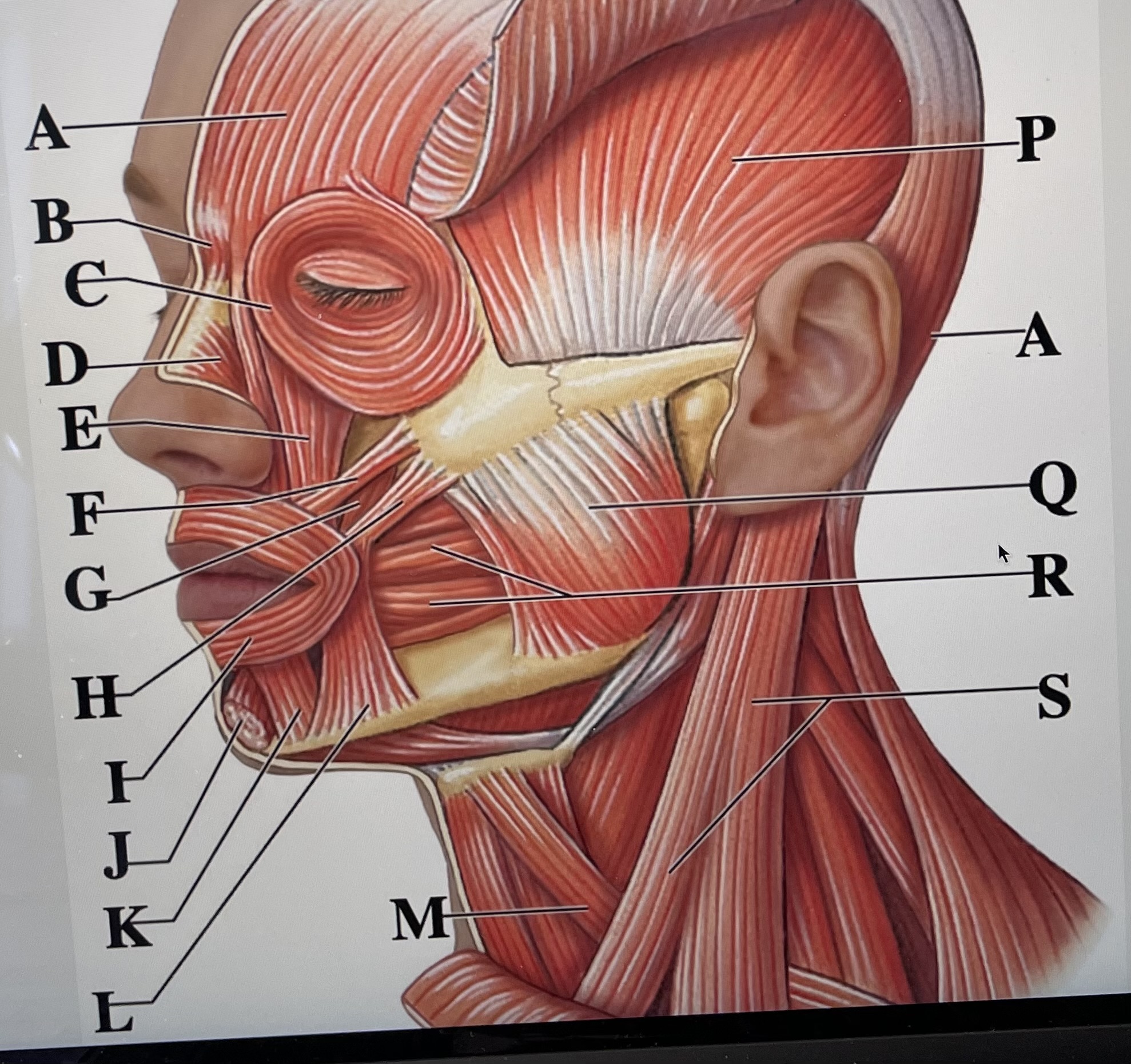 In the figure above, letter  *is the Orbicularis oris and letter* _ is the depressor anguli  oris 
