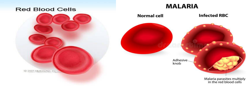 <p>Transmitted through an infected <span style="color: yellow;">Anopheles Mosquito. </span><span>Carrying the </span><span style="color: red;">Plasmodium Parasite </span></p>