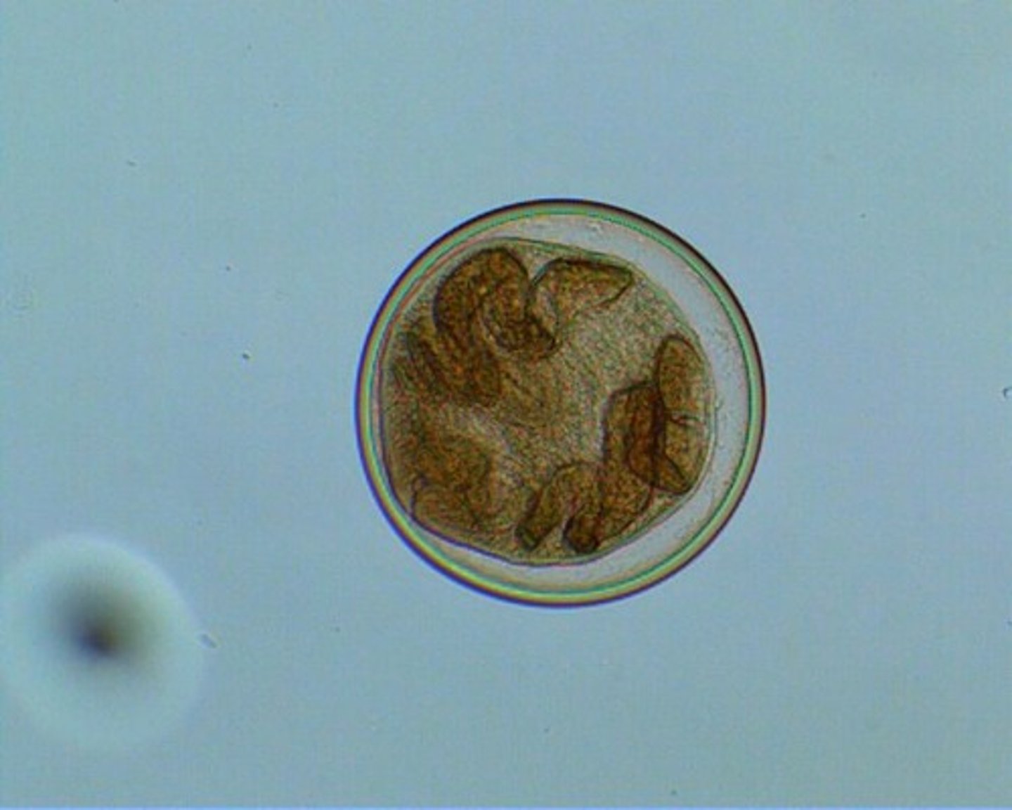 <p>- Tailless encysted late larva of a trematode that is usually the form which is infective for the definitive host</p><p>- Found in trematodes with sexual reproduction as an internal parasite of a vertebrate alternates</p>