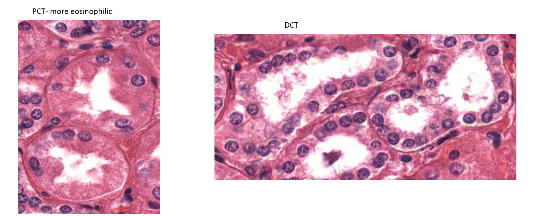 <p>PCT has brush border, stains more intensely than DCT </p>