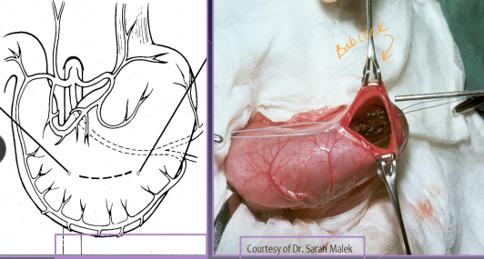 <p><span>Surgical Considerations of the Stomach</span></p>