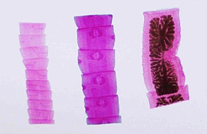 <p>Identify the three proglottids </p>