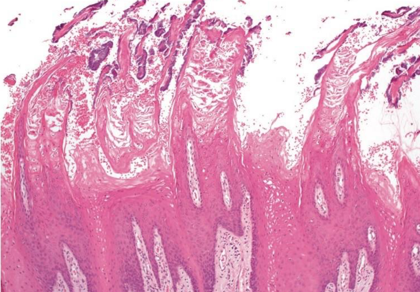 <p>which environmental/reactive lesion:</p>