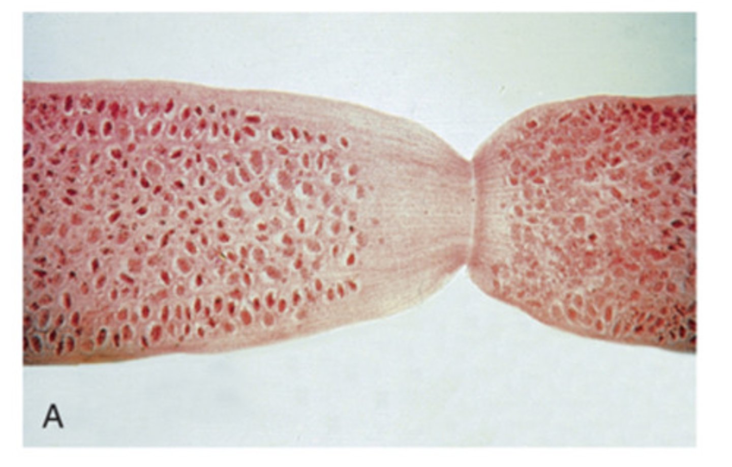 <p>This shows a(n) ___ segment of the tapeworm, Diplydium caninum</p>