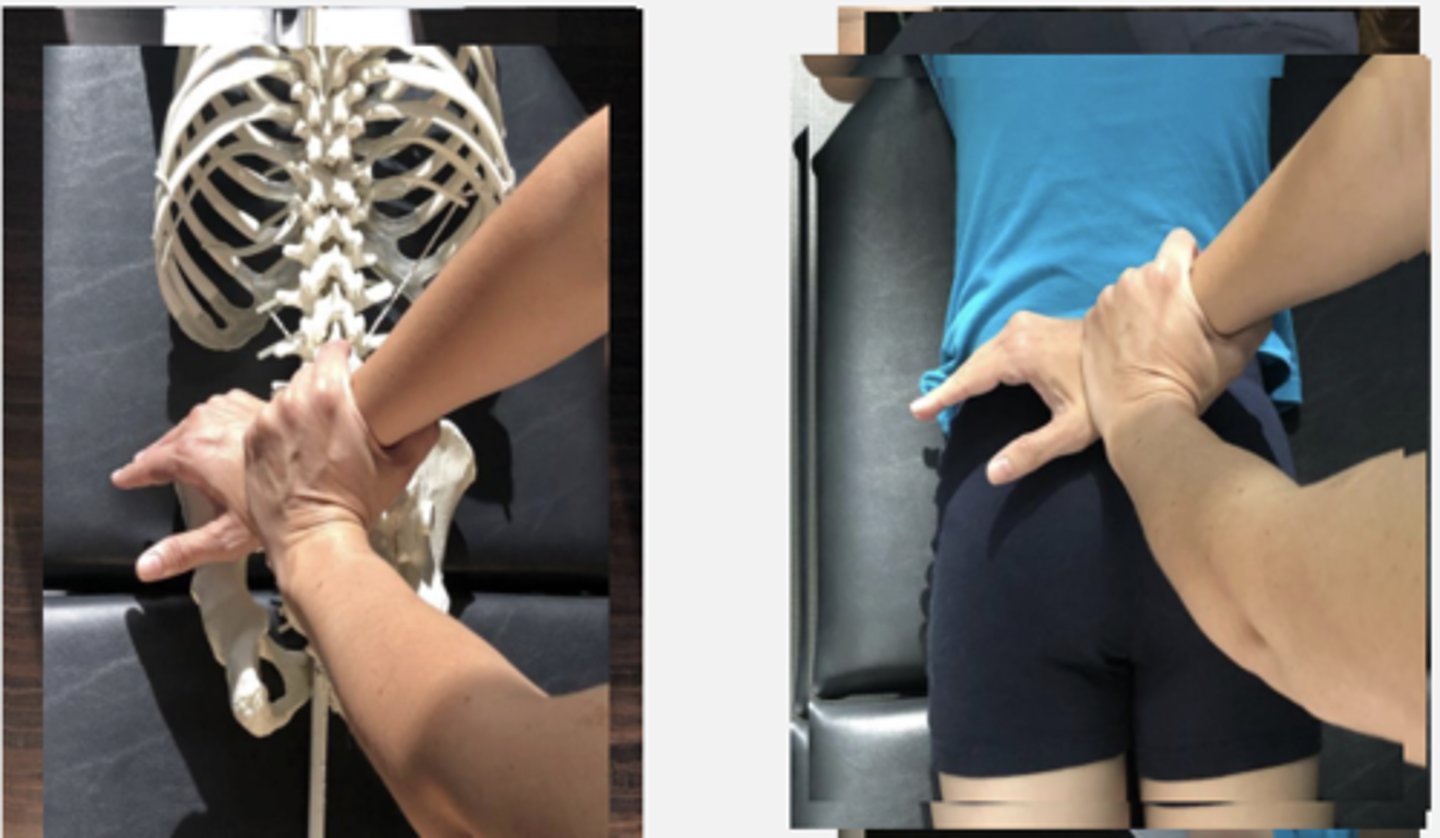 <p>PP: Prone- verbalize how you found the segment</p><p>DP: Square or Modified fencer stance on side opposite the dysfunction</p><p>CH: Cephalad ( R) hand, hypothenar (pisiform) on L PSIS</p><p>IH: Reinforcing CH</p><p>LOD: P-A, M-L</p>