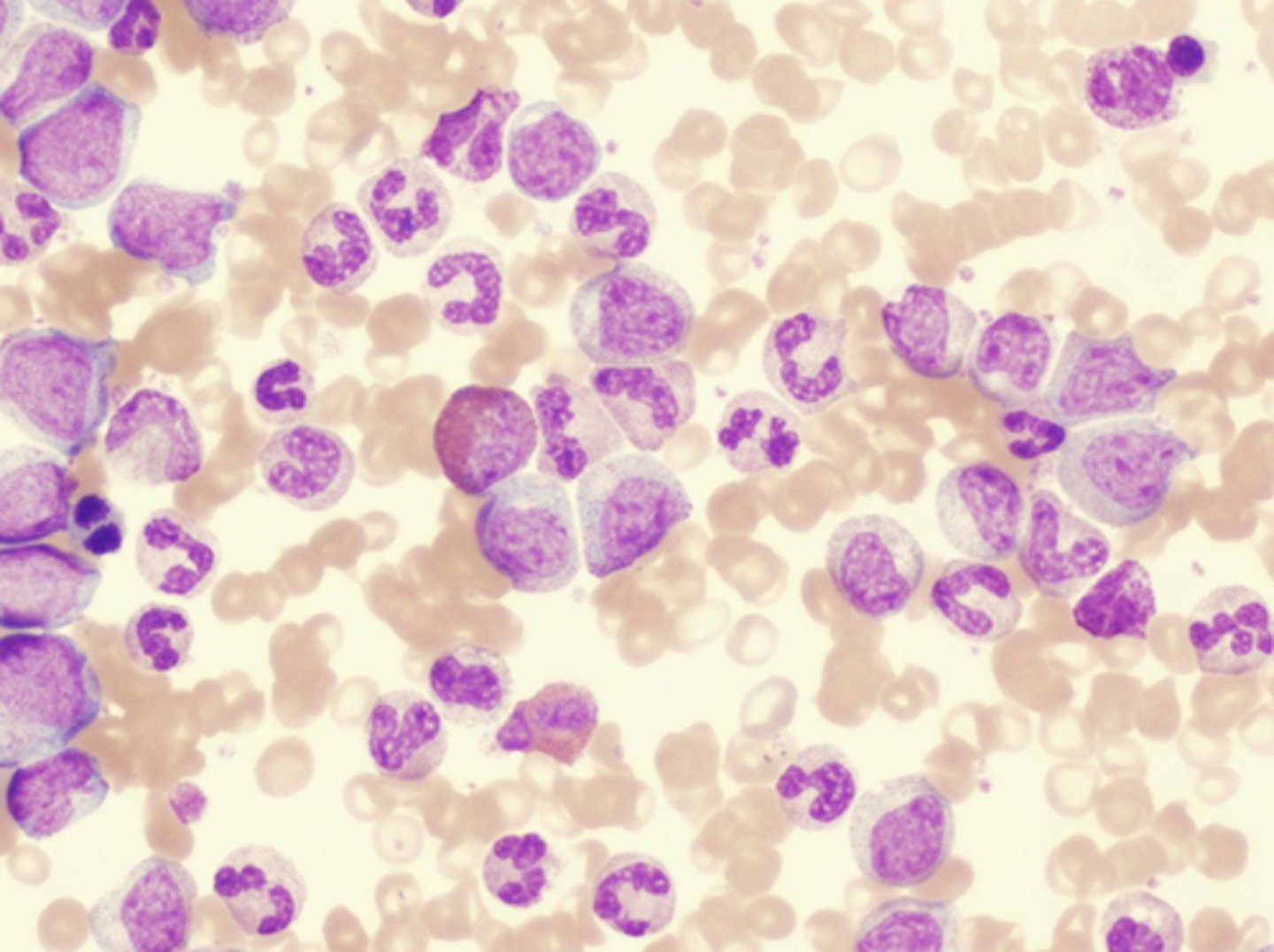 <p>Fibroblasts</p><p>Macrophages</p><p>Neutrophils</p><p>Mast cells</p><p>Plasma</p><p>Adipocytes</p><p>Osteyocyte (bone)</p><p>Chondrocyte (cartilage)</p><p>Areolar Tissues (no defining structure)</p>