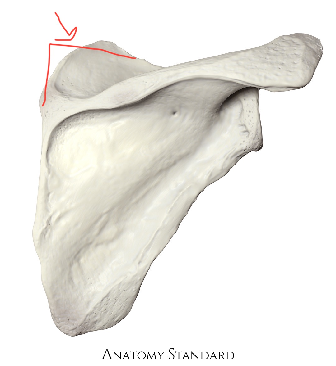 <p>scapula, upper triangle point, closer to spine</p>