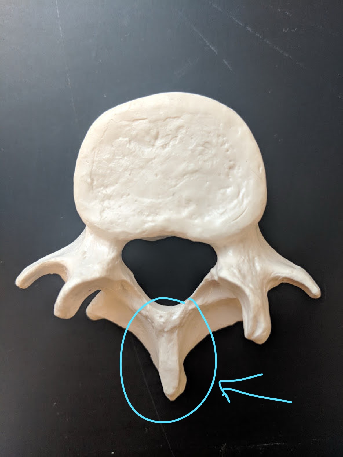 <p>Name this structure</p>