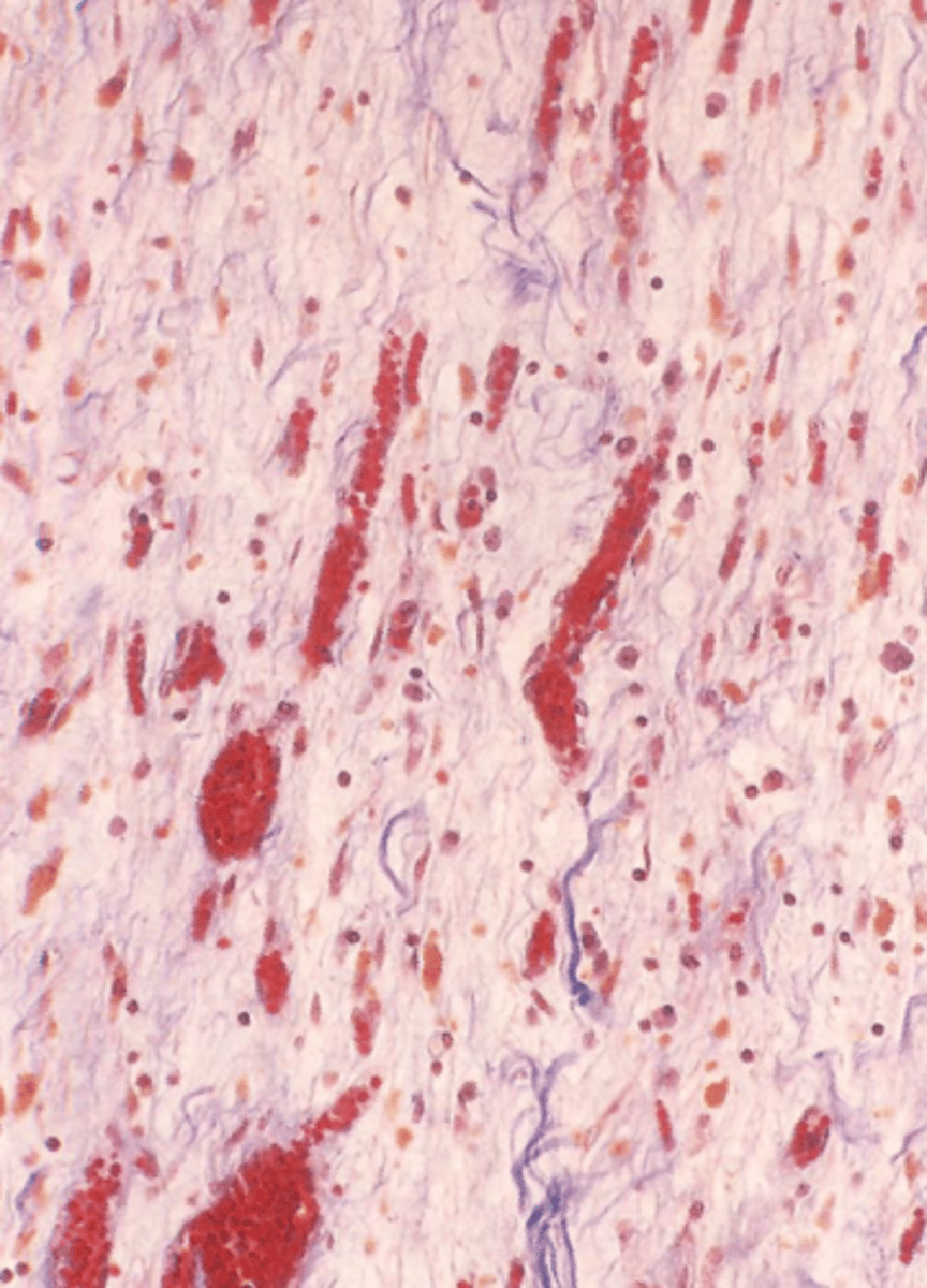 <p>what type of tissue is this?</p>