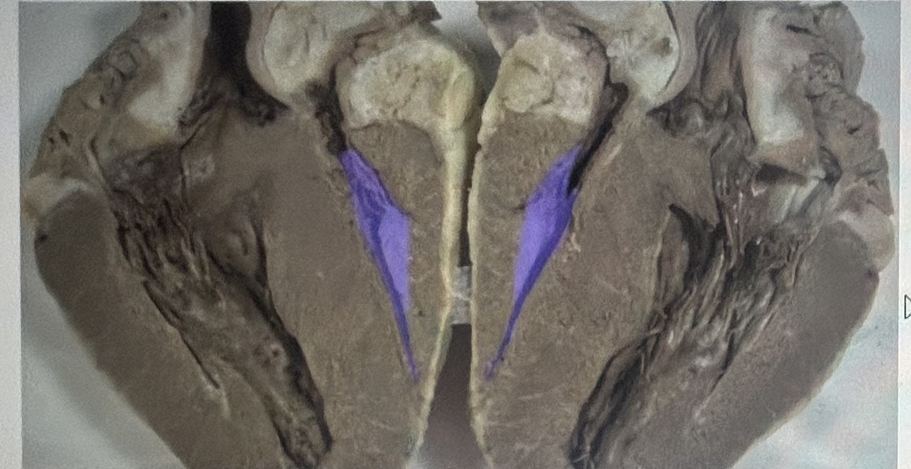 Identify the highlighted sheep heart structure (frontal section) 