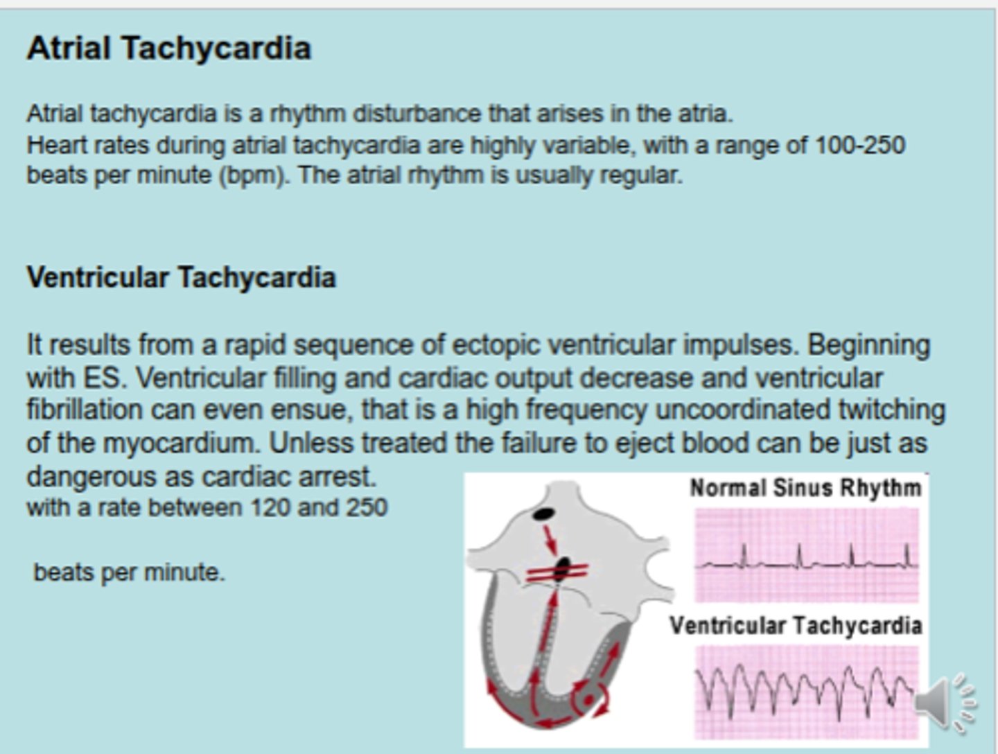 <p>Atrial Tachycardia : 100-350 bpm</p><p>Ventricular Tachycardia : 120-250 bpm</p>