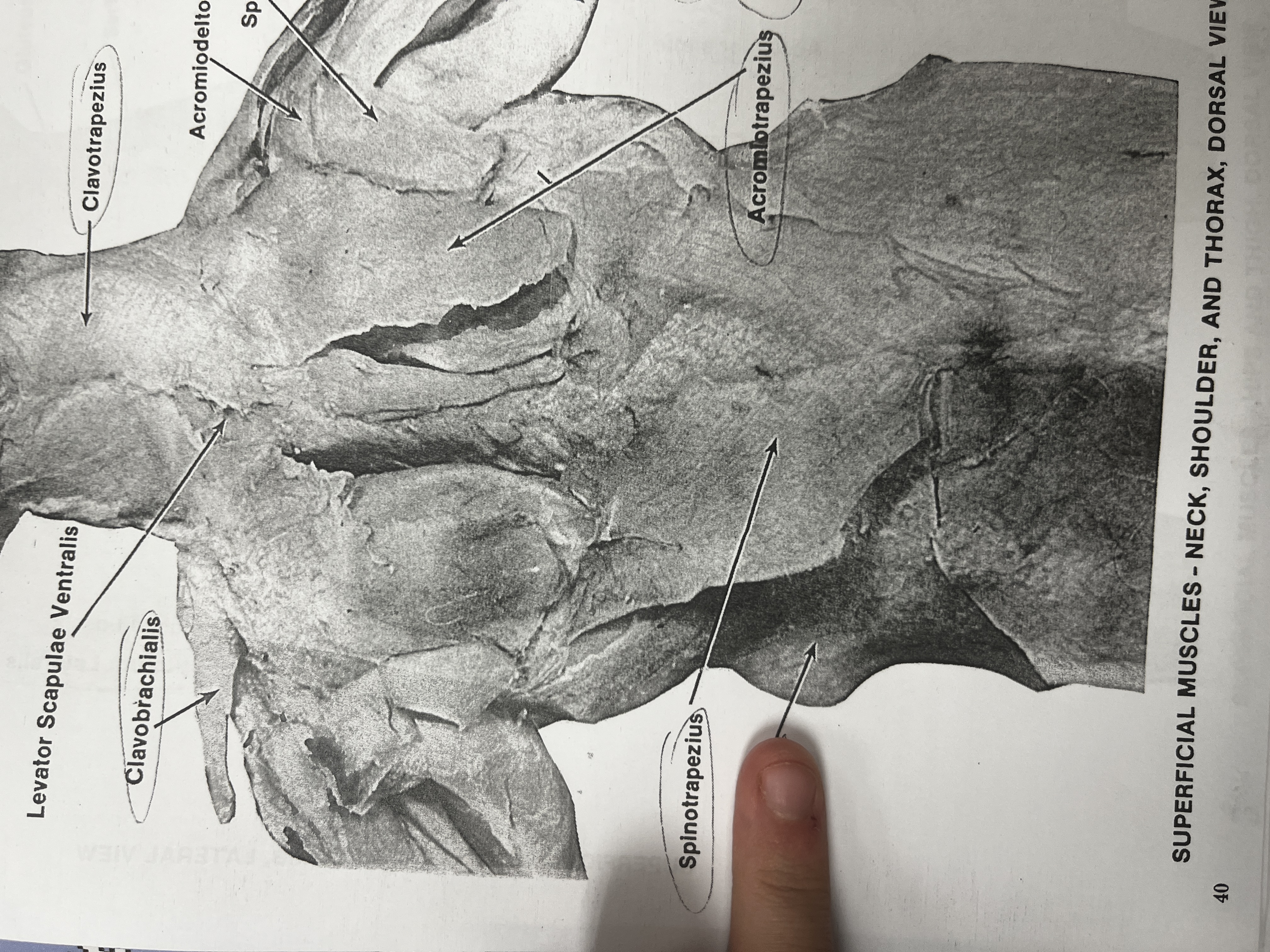 <p>A large muscle on the back that helps extend, adduct, and rotate the arm.</p>