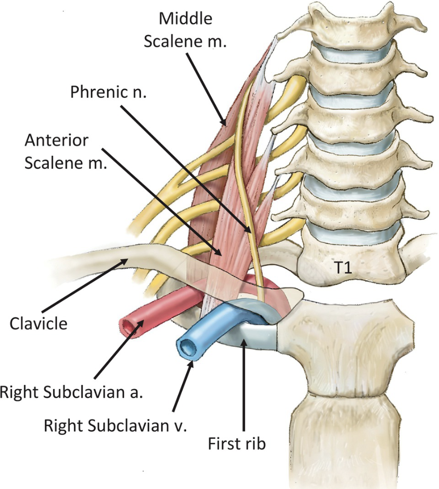 Brachial Plexus, Subclavian Artery and Scalenes