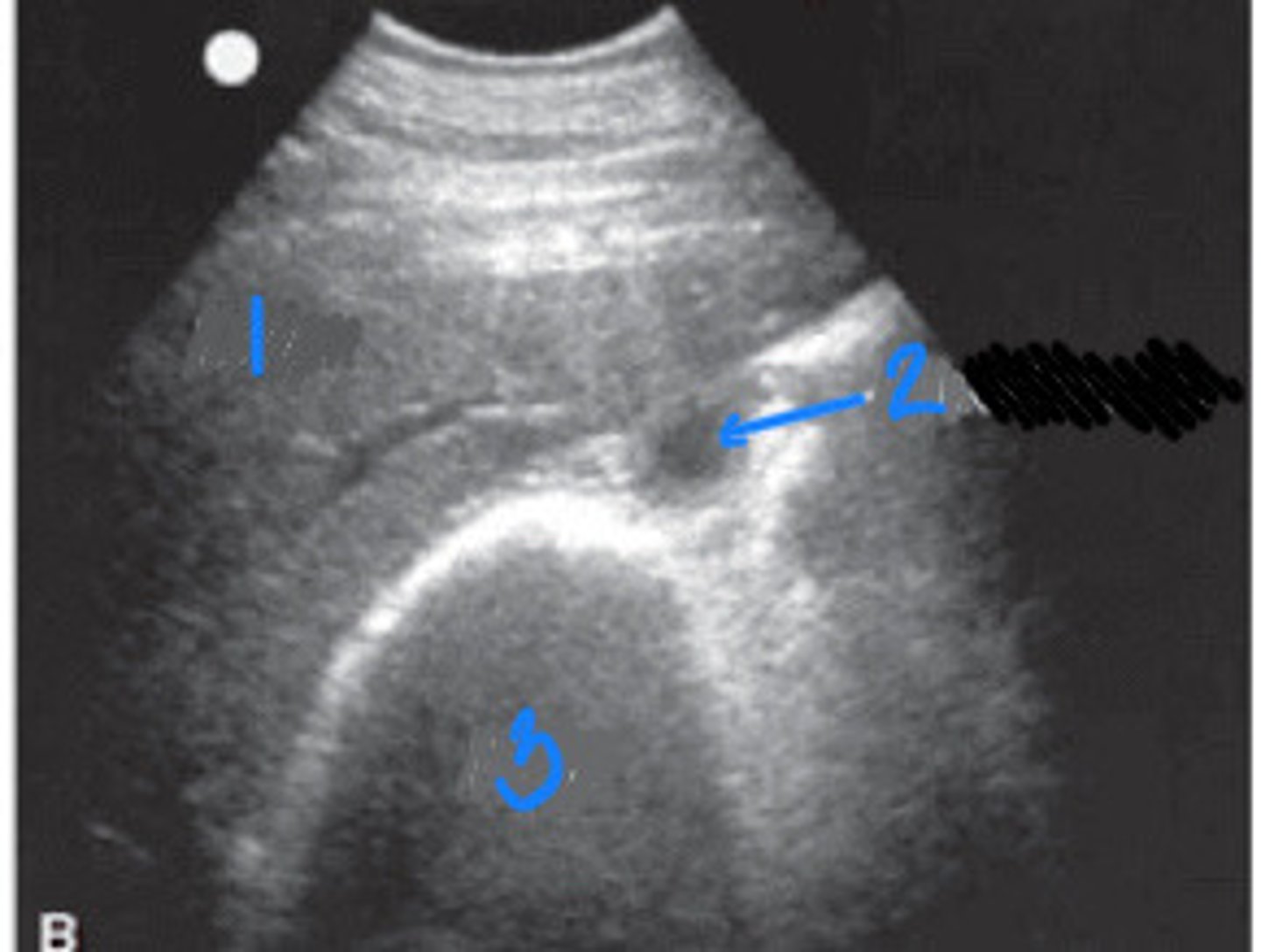 <p>What FLASH view is this in horses and what are the numbers showing you?</p>